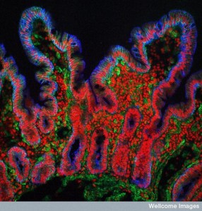 This is a section of small intestine showing the villi, but it could just as easily be an aerial shot of some home-grown tomato patches and heads of lettuce. Photo © wellcome images | Flickr